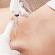 Mesotherapy Training - Atlanta