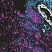 Crick Cancer Research Symposium 2024