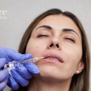 Advanced Lip Filler Injection Techniques - Atlanta, GA